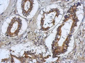 Anti-RASAL2 antibody [C2C3], C-term used in IHC (Paraffin sections) (IHC-P). GTX120989