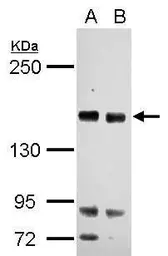 Anti-RASAL2 antibody [C2C3], C-term used in Western Blot (WB). GTX120989