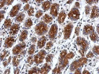 Anti-RILPL2 antibody used in IHC (Paraffin sections) (IHC-P). GTX121000