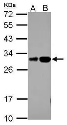 Anti-RILPL2 antibody used in Western Blot (WB). GTX121000