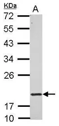 Anti-RNF5 antibody used in Western Blot (WB). GTX121006