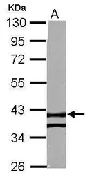 Anti-RTN4IP1 antibody used in Western Blot (WB). GTX121015