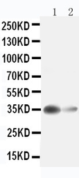 Anti-Arginase 1 antibody used in Western Blot (WB). GTX12102
