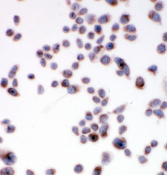 Anti-SSR3 antibody used in Immunocytochemistry/ Immunofluorescence (ICC/IF). GTX12103