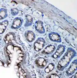 Anti-SSR3 antibody used in IHC (Paraffin sections) (IHC-P). GTX12103