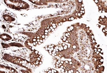 Anti-SSR3 antibody used in IHC (Paraffin sections) (IHC-P). GTX12103