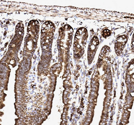 Anti-SSR3 antibody used in IHC (Paraffin sections) (IHC-P). GTX12103