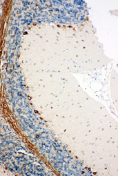 Anti-SSR3 antibody used in IHC (Paraffin sections) (IHC-P). GTX12103