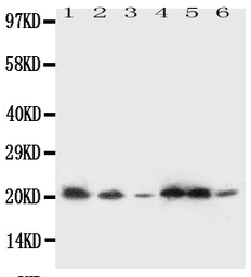 Anti-SSR3 antibody used in Western Blot (WB). GTX12103