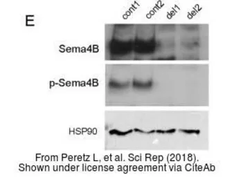 Anti-SEMA4B antibody used in Western Blot (WB). GTX121035