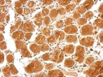 Anti-SEMA4B antibody used in IHC (Paraffin sections) (IHC-P). GTX121035