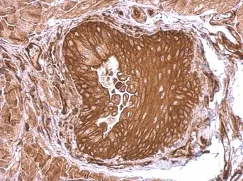 Anti-SEMA4B antibody used in IHC (Paraffin sections) (IHC-P). GTX121035