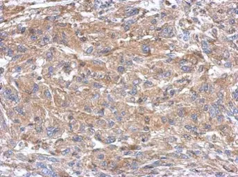 Anti-SEMA4B antibody used in IHC (Paraffin sections) (IHC-P). GTX121035