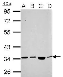 Anti-SH3YL1 antibody used in Western Blot (WB). GTX121041