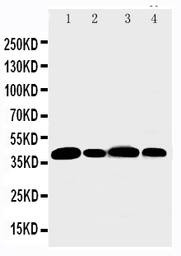 Anti-Aurora B antibody used in Western Blot (WB). GTX12105