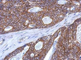 Anti-SLITRK5 antibody [N1N2], N-term used in IHC (Paraffin sections) (IHC-P). GTX121057