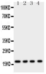 Anti-Myoglobin antibody used in Western Blot (WB). GTX12106