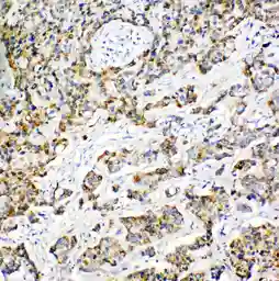 Anti-PRX III antibody used in IHC (Paraffin sections) (IHC-P). GTX12108