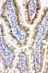 Anti-PRX III antibody used in IHC (Paraffin sections) (IHC-P). GTX12108