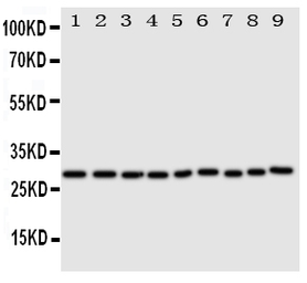 Anti-PRX III antibody used in Western Blot (WB). GTX12108