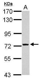 Anti-TMEM62 antibody used in Western Blot (WB). GTX121105