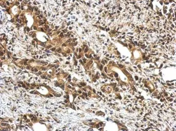 Anti-Ubiquilin 4 antibody [N2C2], Internal used in IHC (Paraffin sections) (IHC-P). GTX121126
