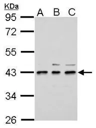 Anti-UPP2 antibody used in Western Blot (WB). GTX121130
