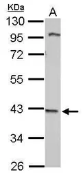Anti-WDR69 antibody used in Western Blot (WB). GTX121145