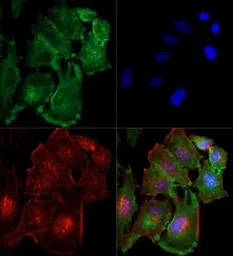 Anti-NAK / TBK1 antibody [108A429] used in Immunocytochemistry/ Immunofluorescence (ICC/IF). GTX12116