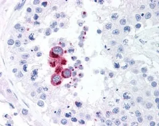 Anti-NAK / TBK1 antibody [108A429] used in IHC (Paraffin sections) (IHC-P). GTX12116