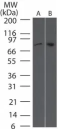Anti-NAK / TBK1 antibody [108A429] used in Western Blot (WB). GTX12116