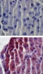 Anti-TLR2 antibody used in IHC (Paraffin sections) (IHC-P). GTX12118