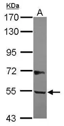 Anti-B3GALNT2 antibody [N1C2] used in Western Blot (WB). GTX121194
