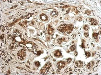 Anti-CC2D2B antibody used in IHC (Paraffin sections) (IHC-P). GTX121199