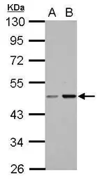 Anti-CC2D2B antibody used in Western Blot (WB). GTX121199