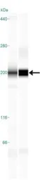 Anti-TLR8 antibody [44C143] used in Western Blot (WB). GTX12120