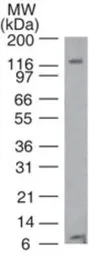 Anti-TLR8 antibody [44C143] used in Western Blot (WB). GTX12120