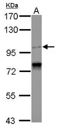 Anti-CCDC52 antibody [C2C3], C-term used in Western Blot (WB). GTX121201