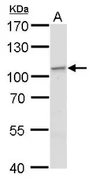 Anti-EXOC2 antibody used in Western Blot (WB). GTX121228