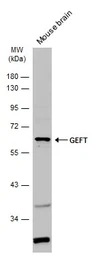 Anti-GEFT antibody used in Western Blot (WB). GTX121237