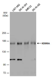 Anti-KDM6A antibody [N2C1], Internal used in Western Blot (WB). GTX121246