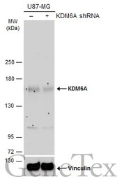 Anti-KDM6A antibody [N2C1], Internal used in Western Blot (WB). GTX121246