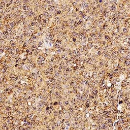 Anti-sRANKL antibody [12A380] used in IHC (Paraffin sections) (IHC-P). GTX12125