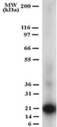 Anti-sRANKL antibody [12A380] used in Western Blot (WB). GTX12125