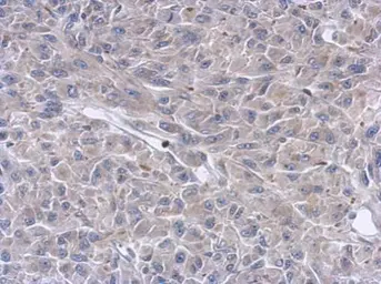 Anti-Keratin 36 antibody used in IHC (Paraffin sections) (IHC-P). GTX121250
