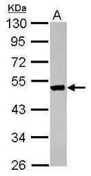 Anti-Keratin 36 antibody used in Western Blot (WB). GTX121250