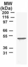 Anti-TROY antibody used in Western Blot (WB). GTX12126