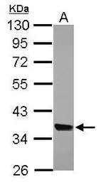 Anti-MRPL44 antibody used in Western Blot (WB). GTX121263