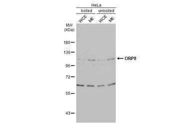 Anti-ORP8 antibody used in Western Blot (WB). GTX121273