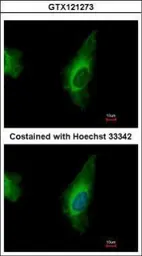 Anti-ORP8 antibody used in Immunocytochemistry/ Immunofluorescence (ICC/IF). GTX121273